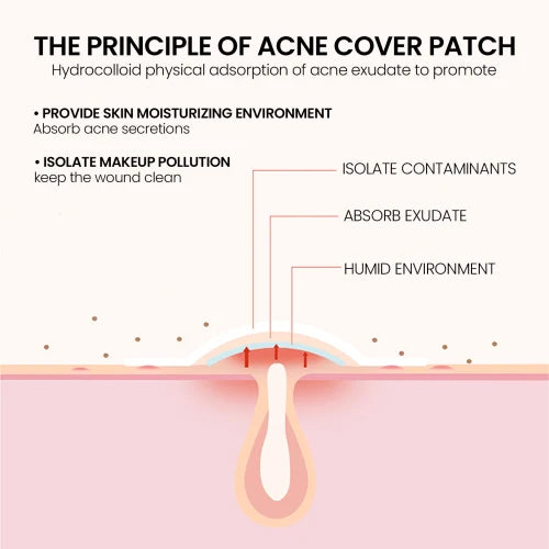 Lightening Spot Mark Covering Acne Pimples Patch