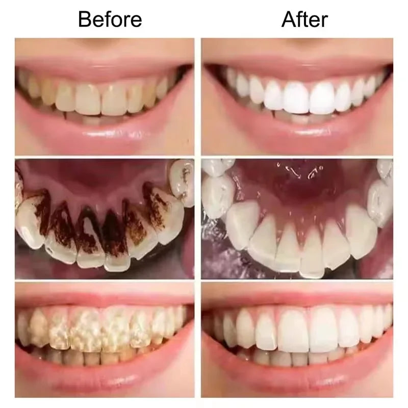 V34 Purple Teeth Whitening Toothpaste