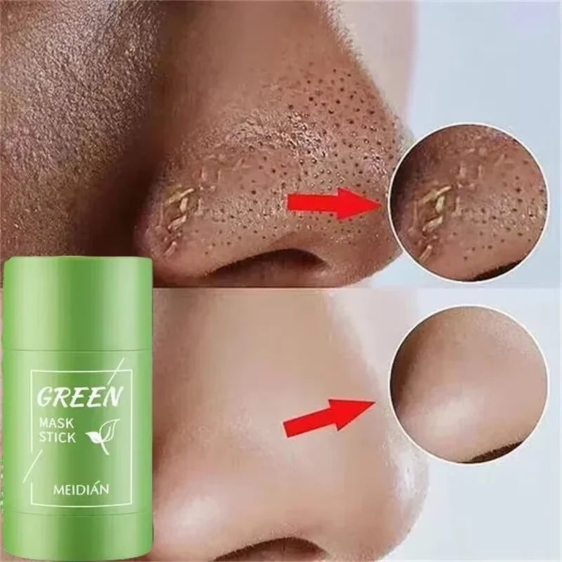 Remove Blackhead Mud Mask