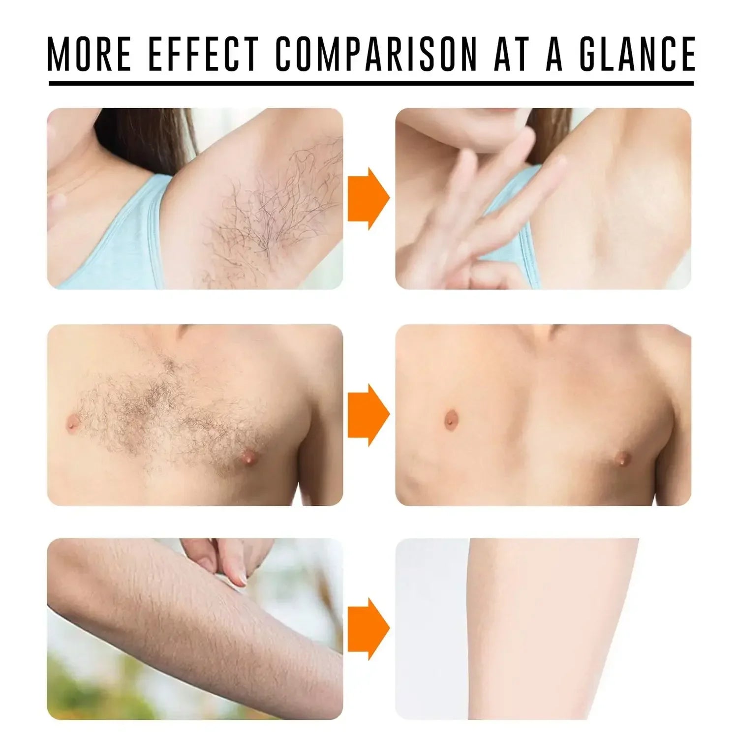 Sakura Hair Removal of Arm Armpit Legs,for Men Woman