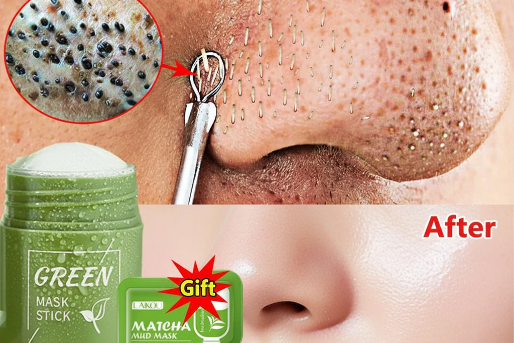 Remove Blackhead Mud Mask