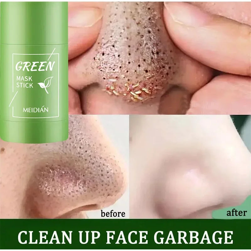 Remove Blackhead Mud Mask