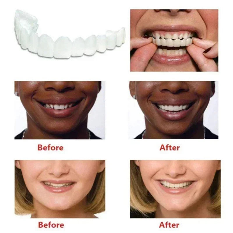 Fake Tooth Cover Perfect Fit Teeth Whitening Teeth