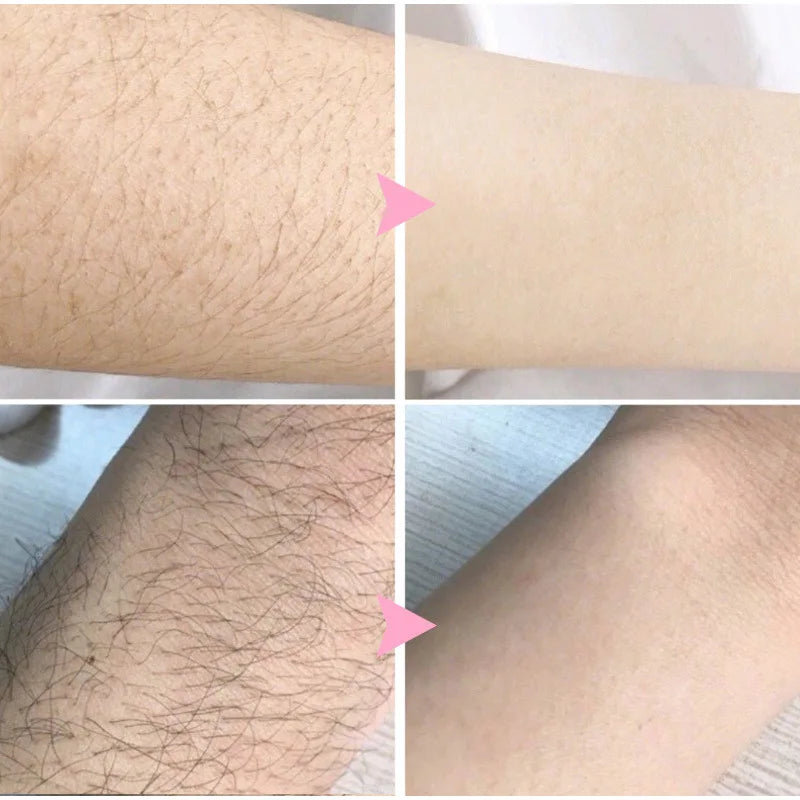 Sakura Hair Removal of Arm Armpit Legs,for Men Woman