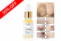 Hair Remover Armpit Legs Arms Hair Growth Inhibitor Beauty