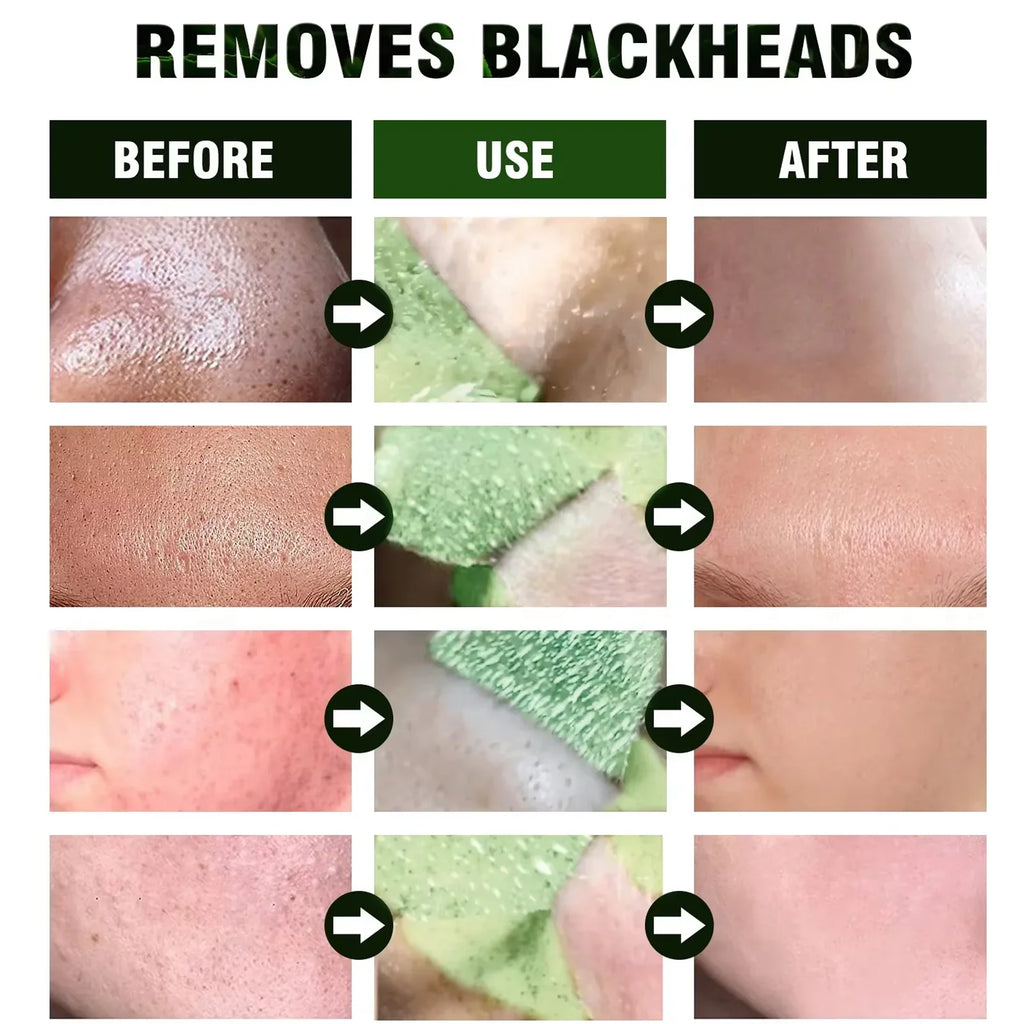 Remove Blackhead Mud Mask